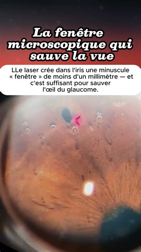 La fenêtre microscopique qui sauve la vue