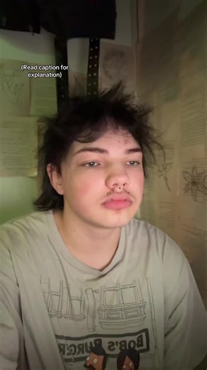 My Journey with Hypermobility Ehlers-Danlos Syndrome