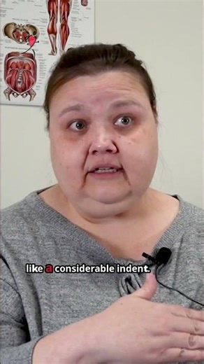 The Simplest Way to Reverse Lymphedema Leg Swelling #lifehack #remedy #physicaltherapy