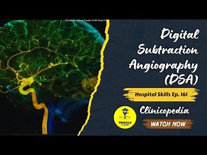 Digital Subtraction Angiography (DSA) 🧠 | Clinicopedia Ep 161 NCLEX | NORCET | Voogly by Sahu Sir