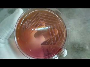 Morgenella morganii Colony Morphology on Macconkey Agar Demonstration