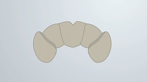 Dissection of the Eye-Brain Complex from Fly Pupae: A Method to Isolate Retinal Tissue