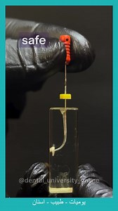 dont use watch winding and up -down motion file at the same time. #Endodontic | Dentist Sufyan T. Algahdari