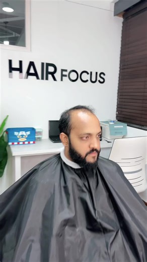 Hair Patch Transformation: Stunning Before and After