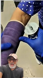 Why a Saw Can Be Safe for Cutting Casts😳 #fblifestyle | Boyaks Recipes