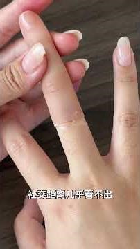 Young man tries prosthetic hand. Can you tell?