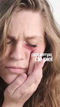 Candidiasis intestinal: los hongos que nadie te mira