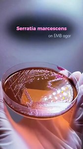 Microbiology is fun ❣️ #LabLife #microbiology | Lab life