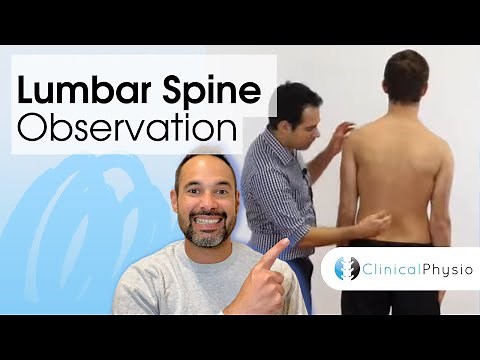 Lumbar Spine Observation | Clinical Physio
