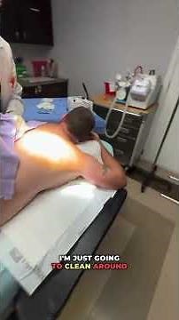 Lipoma Removal: The Surgical Process #LipomaRemoval