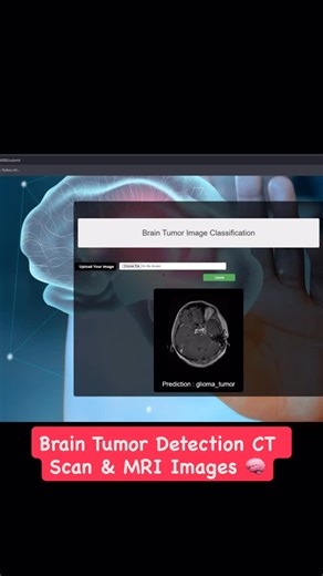 Engineering Projects on Instagram: "Brain Tumor Detection using Machine Learning 🧠🧑‍⚕️ The use of magnetic resonance imaging (MRI) for detecting and diagnosing brain abnormalities is widespread; however, evaluating MRI scans to screen for possible tumors is a tedious and time-consuming process for even the most skilled radiologists. In addition, healthy brain tissue can be hard to tell apart from some types of early-stage tumors. Computer-aided analysis systems exist that can assist healthcare