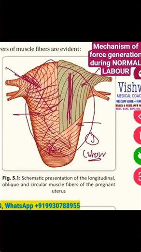 Mechanism of Force generation in NORMAL LABOUR from all sides As per arrangement of muscle fibres