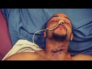 Tree surgeon nearly took his own head off after losing control of his chainsaw