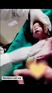 182K views · 1.8K reactions | Doctor helped massage baby chest newborn not cry | The birth room | Facebook