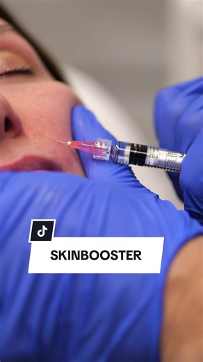 Drei Gründe für Skinbooster Behandlung
