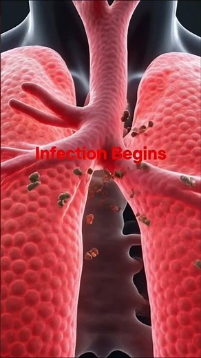 What Happens During Pneumonia? | Lung Infection Explained in 3D