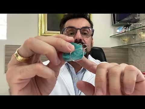 Bionator for the treatment of Class II malocclusion