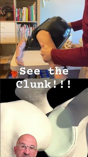 Saw the clunk? Now describe it! Shoulder Dislocation Reduction #orthopedic #shoulderdislocation