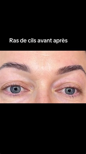 ✨ INTENSIFICATION CILIAIRE RADICILE ✨ Ce n’est pas un trait. Ce n’est pas un eye-liner. 👉 C’est une densification invisible à la racine des cils. L’intensification ciliaire radicile consiste à déposer le pigment entre les cils, directement à la racine, pour : • intensifier le regard sans maquillage visible • donner l’illusion de cils plus fournis • structurer l’œil tout en restant ultra naturel 💡 Résultat : Un regard plus profond, plus net, comme naturellement souligné, même au réveil. Aucun e