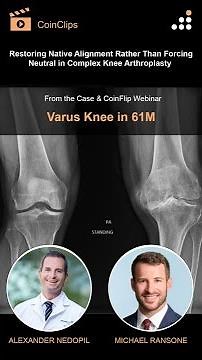 Restoring Native Alignment Rather Than Forcing Neutral in Complex Knee Arthroplasty