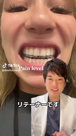 リテーナーの重要性と使用法