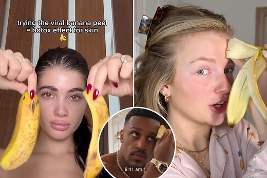 Why TikTokers are rubbing banana peels on their faces — and whether it works, according to doctors