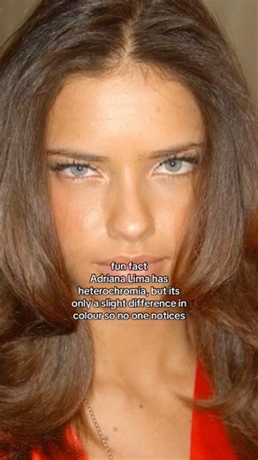 Adriana Lima has heterochromia but it's only a slight difference in colour so no one notices 😩
