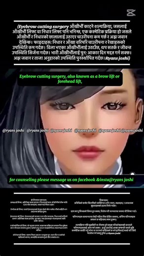 AI Overview Eyebrow cutting surgery, also known as a brow lift or forehead lift, is a cosmetic procedure that aims to lift the eyebrows and reduce forehead wrinkles by repositioning tissues and muscles, often through incisions near the hairline or temples. Here's a more detailed explanation: What is a Brow Lift? A brow lift is a surgical procedure designed to address sagging eyebrows, wrinkles on the forehead, and frown lines. It can create a more youthful and refreshed appearance by lifting the