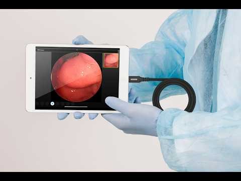 COMedia Cam - an iPad app for USB endoscope cameras.