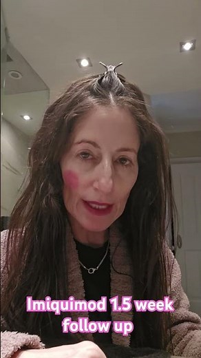imiquimod treatment progression #skincancer