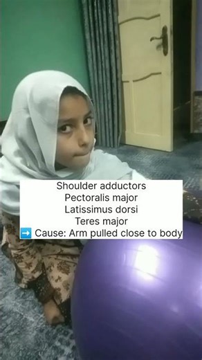 “Erb’s Palsy in a 9-Year-Old: Live Demonstration by Dr. Abid” #drabid #erbspalsy #mirrortherapy