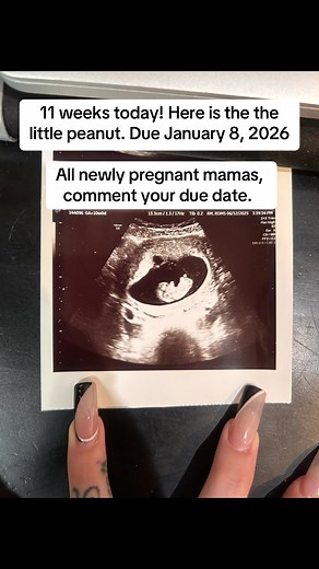 Ultrasound Moments at 11 Weeks Pregnant