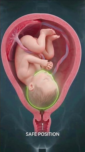 Baby Position in Womb | Safe vs Unsafe Fetal Position Explained