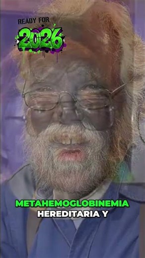 Pato Mandarín y la Extraña Enfermedad Azul ¡Increíble