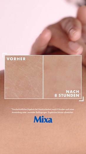 Trockene, raue oder unebene Haut? Entdecke Mixa Urea Cica Repair Hauterneuernde Creme mit 10% glättender Urea & Niacinamid. | Mixa