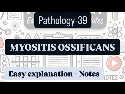 Myositis ossificans |Pathology-39 |With easy explanation and handwritten notes.