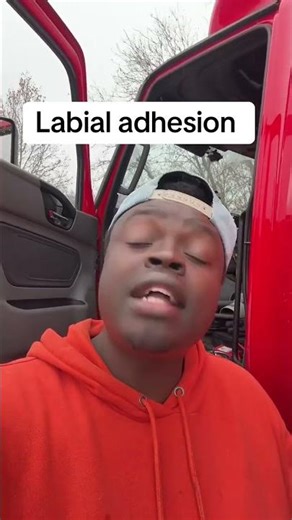 Labial adhesion