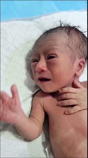 What Is Imperforate Anus? block anus | Congenital Anorectal Malformations in Newborns. #education