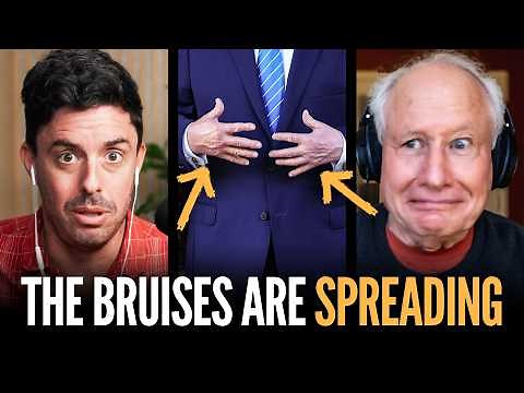 Why Are Both of Trump’s Hands Bruised Now? (w/ Bill Kristol) | The Bulwark Podcast