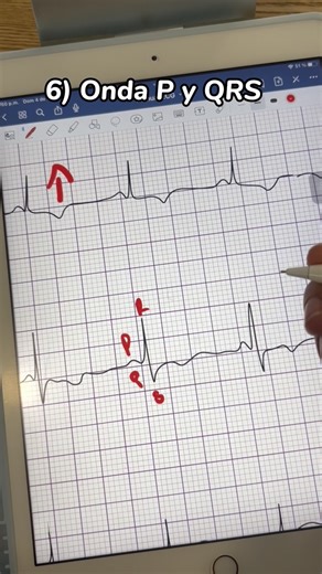 Good Doctor • Libros para médicos on Instagram: "Manual de electrocardiograma ⚡️ Incluye: - Explicación conceptos básicos. - Aspectos del electrocardiograma normal. - Criterios diagnósticos para cada patología. - 40 casos clínicos con respuestas. No es suficiente estudiar leyendo, debes practicar lo suficiente para aprender a tener una secuencia que te permita identificar anormalidades en el electrocardiograma de forma rápida y eficaz ⚡️ El manual está disponible en PDF para adquirir desde cualq