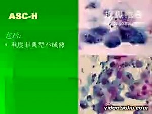 袁晟 解读TBS系统