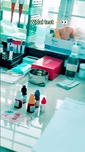 Widal test on pathology Lab report 🧪🗞️