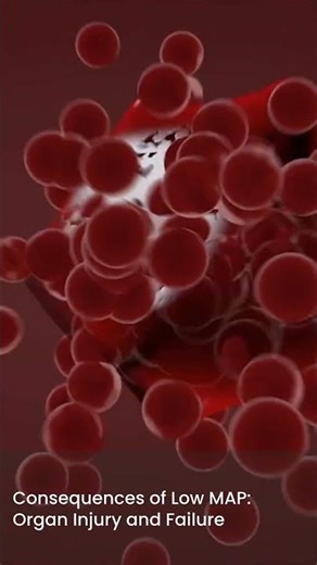 What MAP 60 Means for Organ Perfusion | RN Explains 123