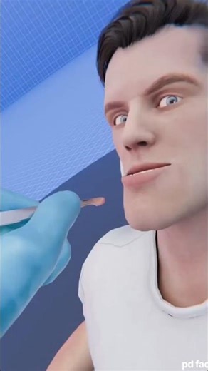 how underbite surgery works #shortvideo