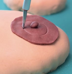 792K views · 2K reactions | Explicación completa del proceso quirúrgico | En modo Madera | Facebook