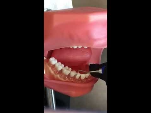 Professor Norrell: Use of Sickle Scaler 204S