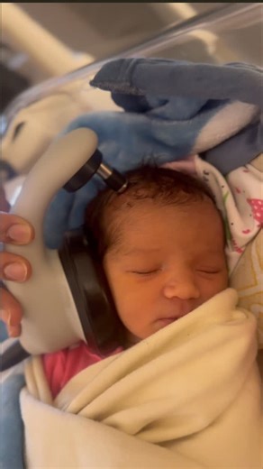 Aparajitha Nagesh on Instagram: "Otoacoustic Emission (OAE) screening is a simple, non-invasive test used to assess hearing in newborns. OAE screening helps check a newborn’s hearing in the first days of life 👶👂 It’s quick, painless, and plays a big role in early detection—because early hearing means better speech and development.” #speechdevelopment #speech #speechtherapy #paediatrician #draparajitha #drlittles #neonatologist #test #OAE #NewbornScreening #PediatricAudiology #HearingHealth"