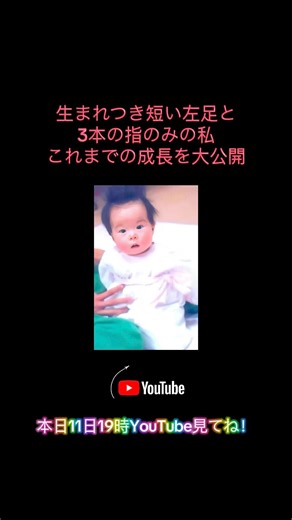 #CongenitalLimbDefect #Disability #ThreeToesOnMyLeftFoot #TrainingSoFar #MyOriginalSong