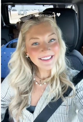 Alittle before and after 👀 | veneer