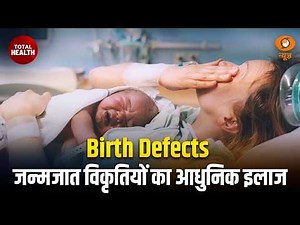 Total Health | Birth Defects जन्मजात विकृतियों का आधुनिक इलाज | Health Awareness | DD News